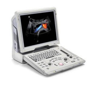 ULTRASONIDO Z6 PORTATIL DOPPLER 4D TRANSDUCTOR CONVEXO Y ENDOCAVITARIO MINDRAY